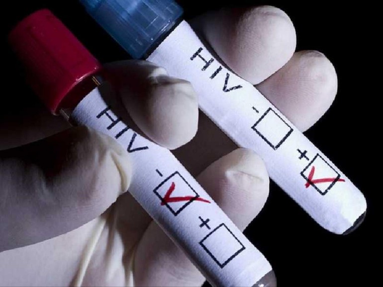 Aids, emergenza continua: è la seconda causa di morte per i ragazzi dai 10 ai 19 anni