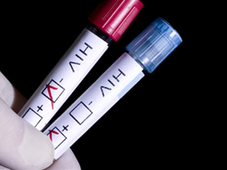 Aids: calano le nuove diagnosi di infezione da Hiv. Ma si arriva più tardi al test