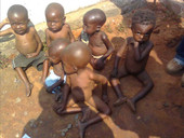 Covid, clima, conflitti: “combinazione letale” che fa crescere la malnutrizione infantile