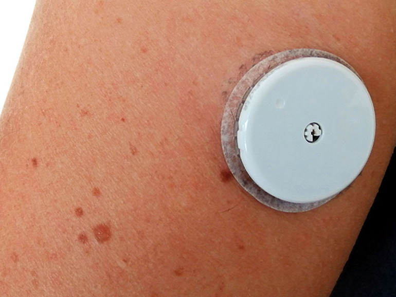 Diabete 1. In arrivo la app "mylifeTM Dose" che programma ed erogare i boli di insulina Diabete 1. In arrivo la app "mylifeTM Dose" che programma ed erogare i boli di insulina