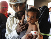 La catastrofe umanitaria in Yemen. 16,2 milioni di persone dovranno affrontare livelli di insicurezza alimentare acuta