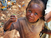 Quello che non si vuole vedere. 5,5 milioni di bambini ogni anno muoiono nel mondo per problemi connessi alla scarsa nutrizione