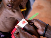 Somalia. Save the Children, oltre mezzo milione bambini a rischio malnutrizione