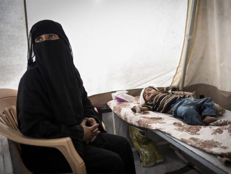 Yemen. Ferraresi (Msf): “I bambini non muoiono più sotto le bombe ma di fame e dissenteria”