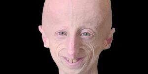 Sammy Basso, una biografia di emozioni