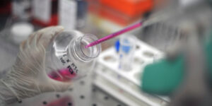 Meningite. Ciccozzi (Campus Bio-Medico): “Niente panico ma ragioniamo in termini di sanità globale”